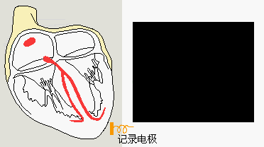 descript