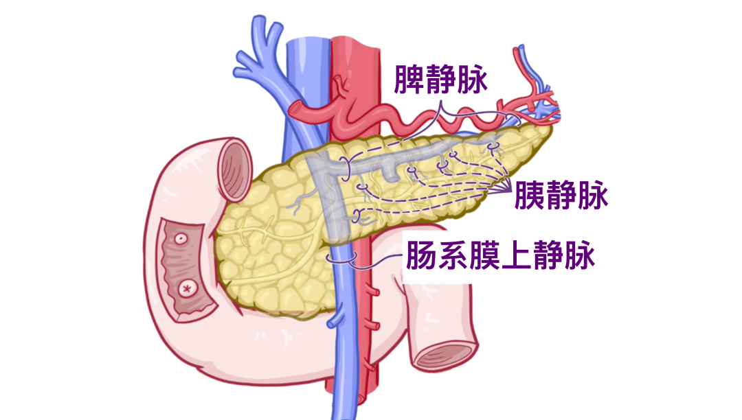 descript