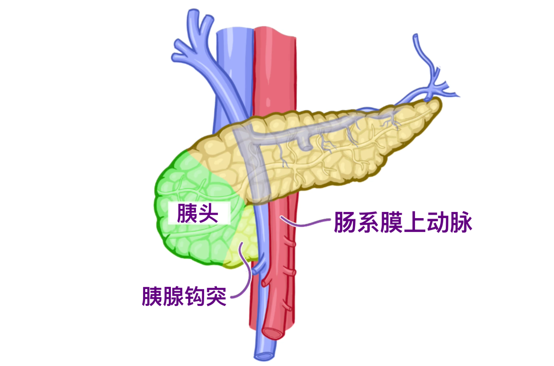 descript